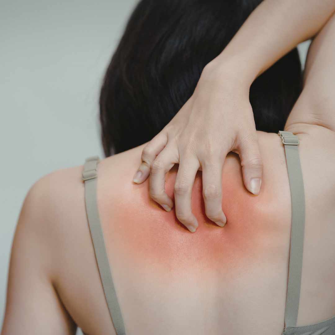 Kvinde holder sig på ryggen ved smerter i skulderblad og området mellem skulderbladene.