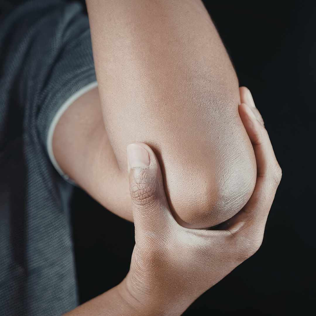 Nærbillede af person med ondt i kroppen og smerter i albuen.
