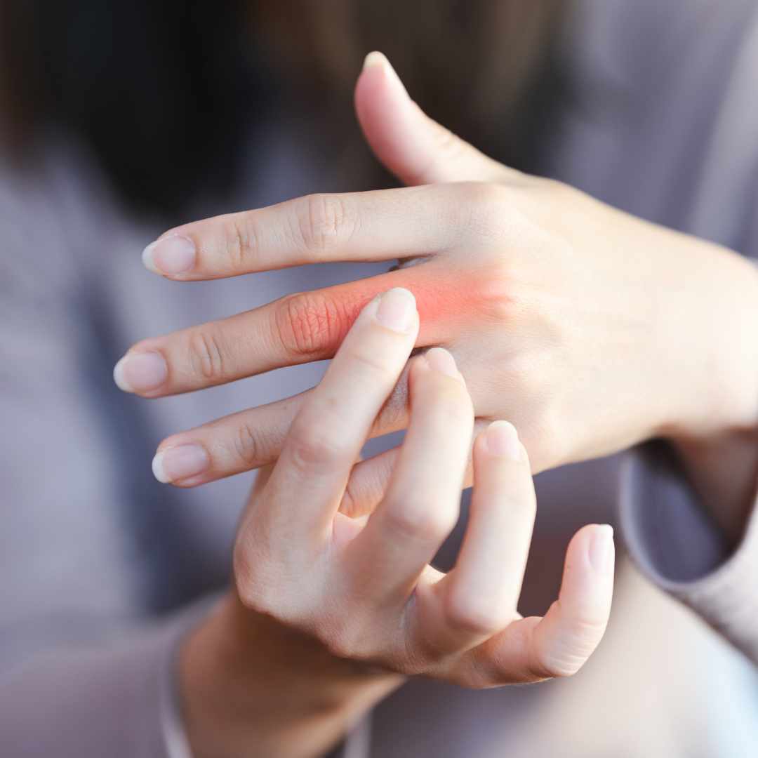 Nærbillede af hænder med fokus på en finger med rød markering ved leddet, der kan indikere springfinger eller betændelsestilstand i fingeren.