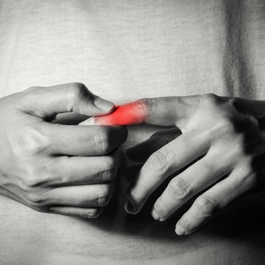 Person holder om en øm og rødmarkeret finger, som illustrerer smerter, irritation eller symptomer på springfinger.